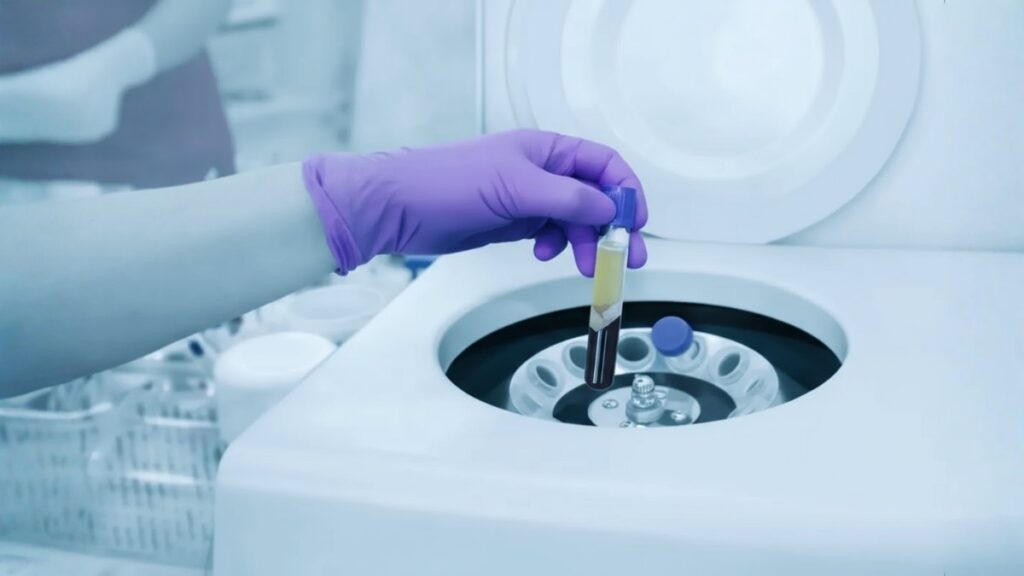 Rathna Fertility Center - LAB